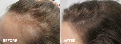 The Australian Luxury - Grow Mode + Conditioner - For More Targeted Hair Loss and Faster Hair Growth with Batana Oil